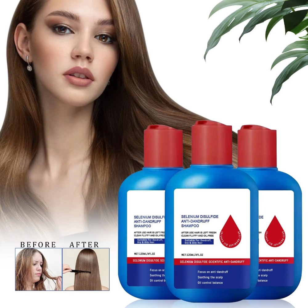 Hair Care Dandruff - 新しい 120 ミリリットルニポリシャンプーオイルコントロール抗フケ硫化セレンシャンプーリフレッシュクレンジングシャンプーヘアケア