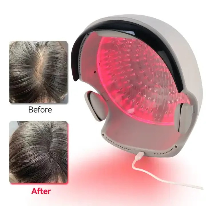 赤色光育毛ヘルメット、光療法ヘアケアキャップ（育毛・髪の強化 - Hair Care Lab のレビューと価格