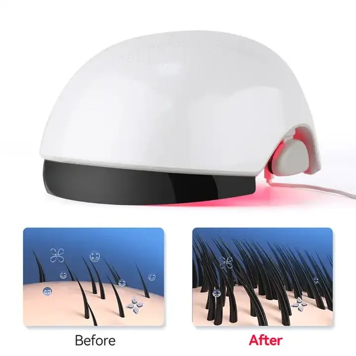 赤色光育毛ヘルメット、光療法ヘアケアキャップ（育毛・髪の強化 - Hair Care Lab のレビューと価格