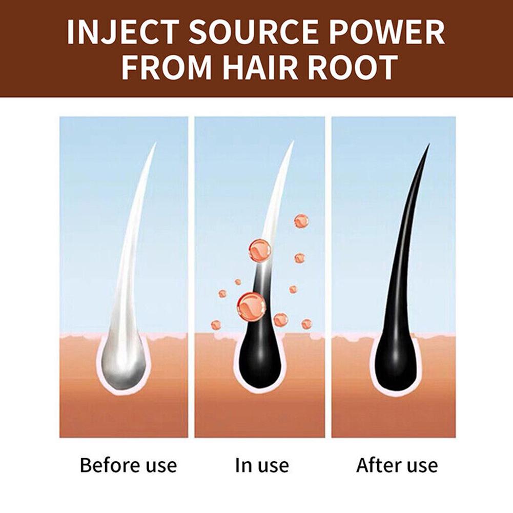 天然ポリゴナム手作り石鹸ディープクレンジング強化栄養シャンプ - Hair Care Dandruff のレビューと価格